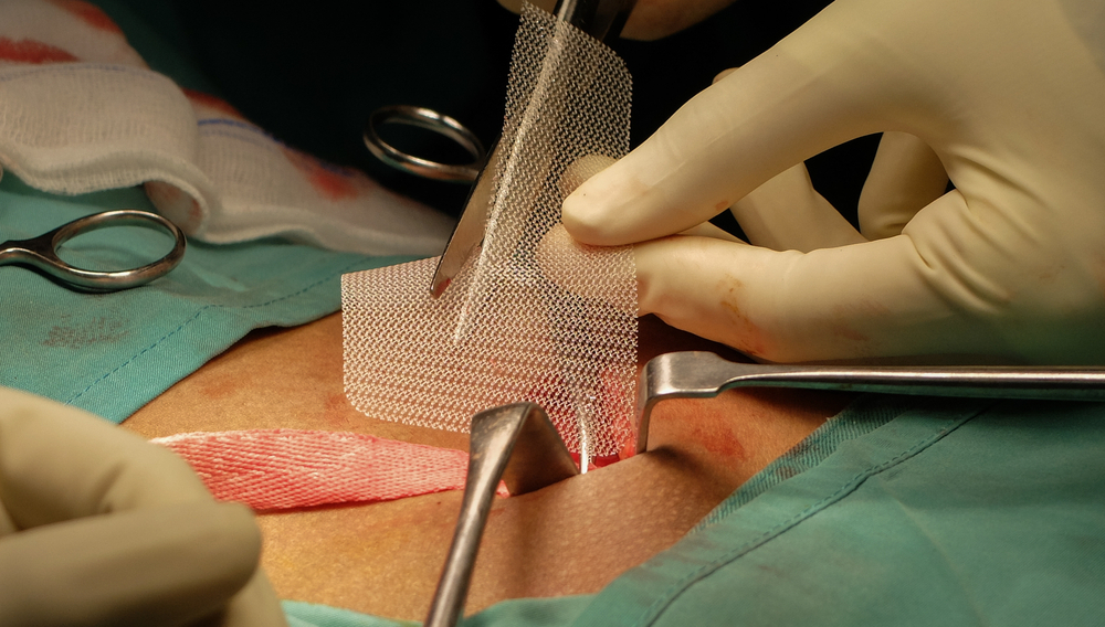 pengobatan hernia 3