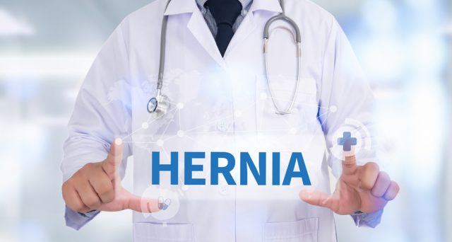 pengobatan hernia