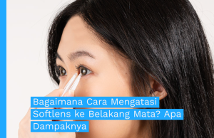 softlens-ke-belakang-mata